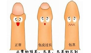 割包皮是为什么,揭秘男性健康与美观的双重益处