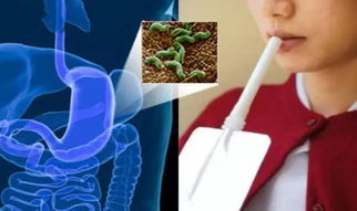 胃镜吹气是检查什么,幽门螺杆菌检测的关键步骤